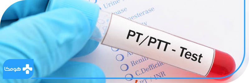 تفسیر آزمایش PT چطور انجام میشود؟